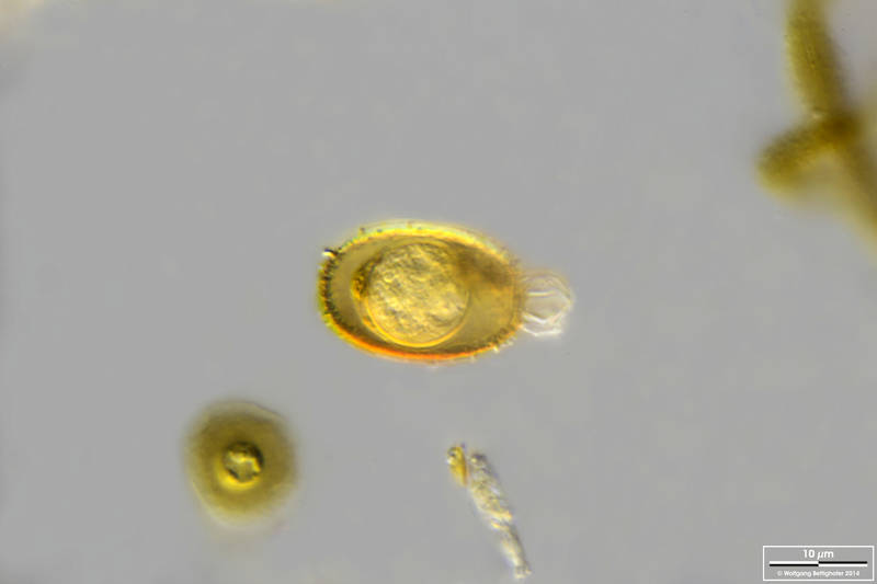 Parasite cysts in Trachelomonas spec.