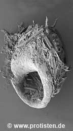 Centropyxis aculeata