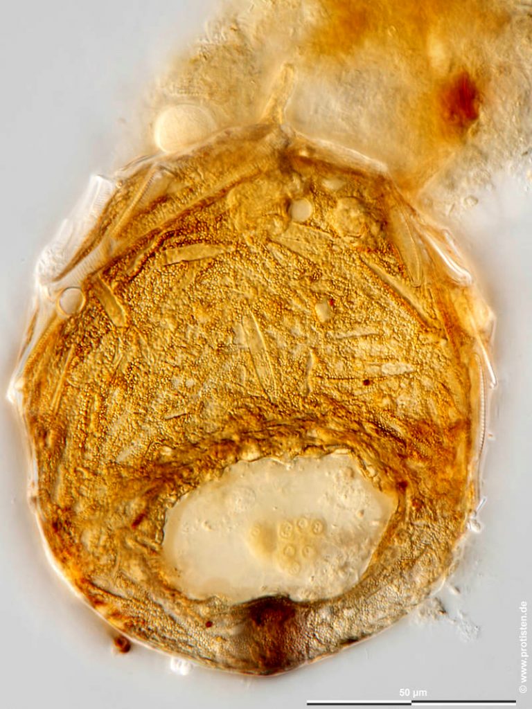 Centropyxis aculeata