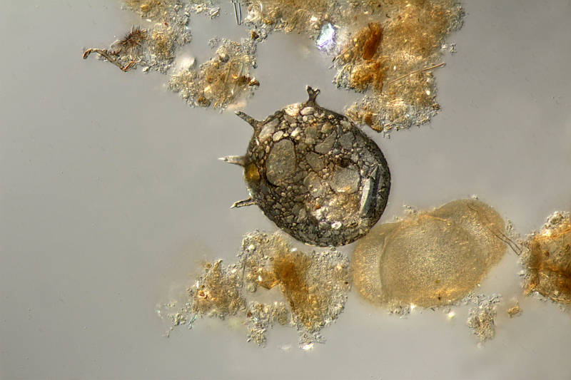 Centropyxis aculeata