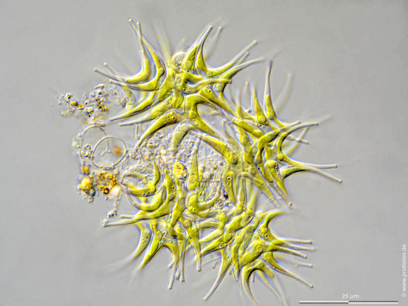 Tetradesmus lagerheimii var. tetradesmoides