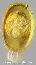 Parasite sporangium in Trachelomonas spec.