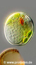 Parasite sporangium in Trachelomonas granulosa